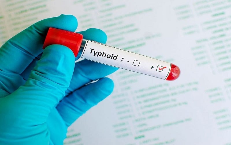 Oti Region battles surge in typhoid fever; over 10,000 cases recorded in first half of 2025