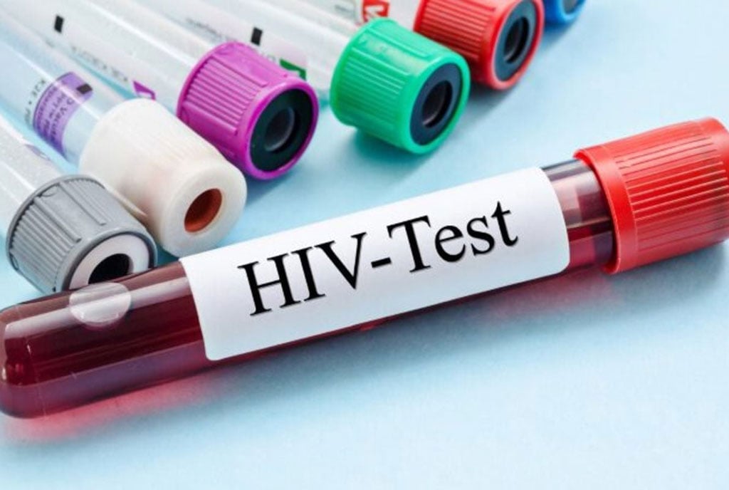 Over half of HIV patients not on treatment – AIDS Commission reveals