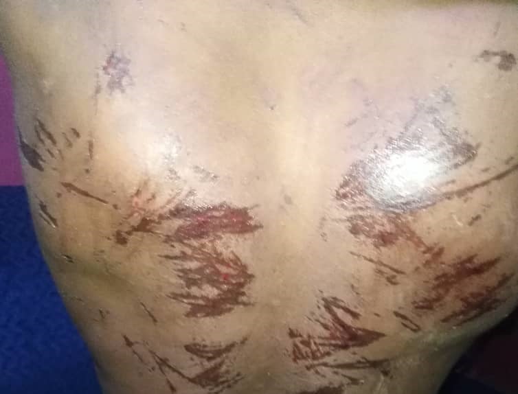 Western Region: 10-year-old boy who was tortured by father responding positively to treatment