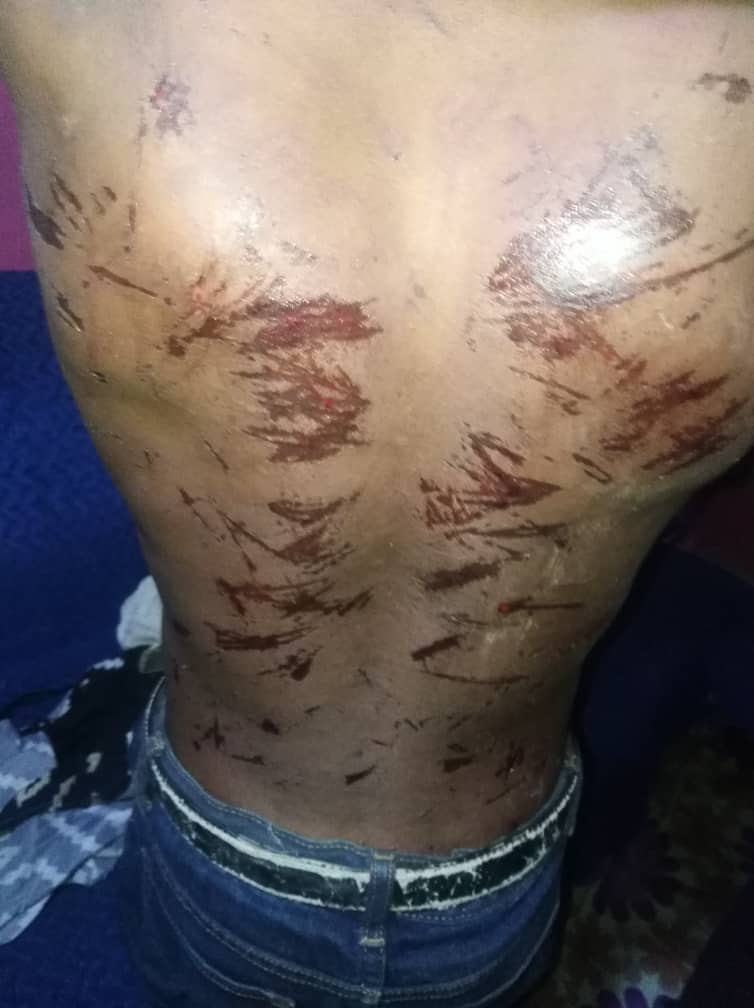 W/R:10-year-old brutalized by father in Diabene over alleged misconduct