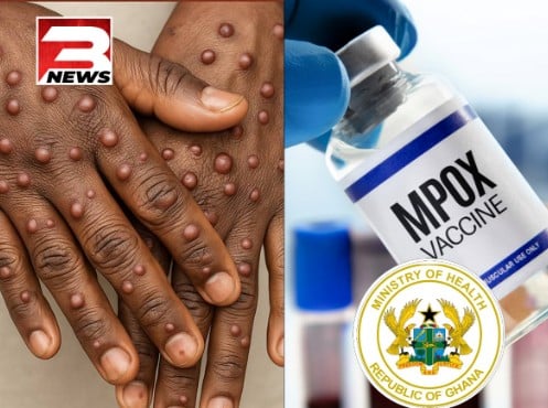 33,600 vaccines secured for Mpox control – Health Minister